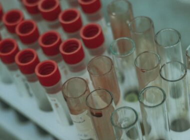 Laboratory tube | Blood Test